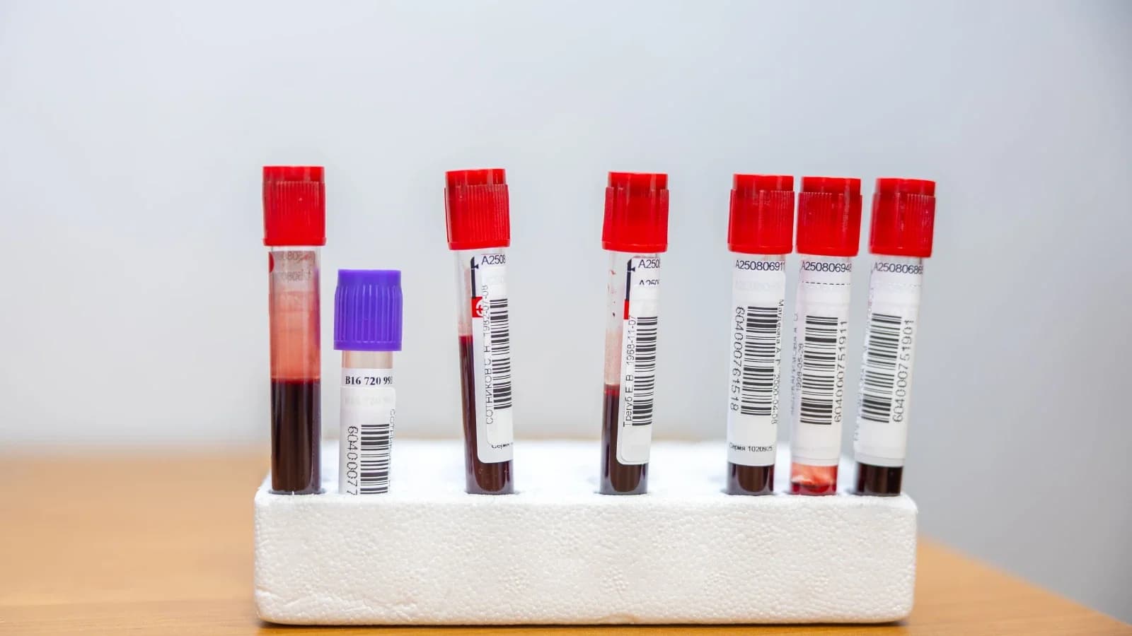 В департаменте здравоохранения рассказали о первых результатах липидограмм ямальцев